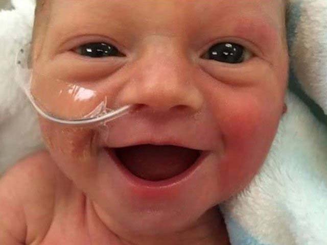 Усмивката на това недоносено бебе дарява надежда на хиляди хора по света